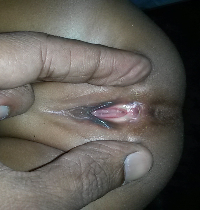 Pediatric G.I. Surgery Image 2